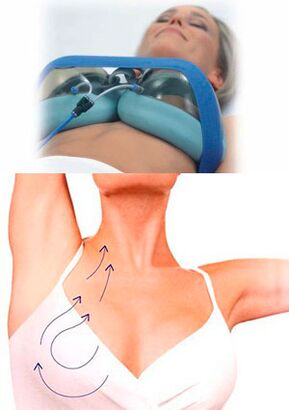Vakuumska masaža za povečanje prsi