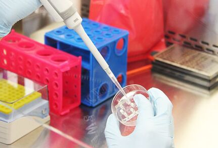 Pregled pacientovih testov pred izvedbo augmentacijske mamoplastike